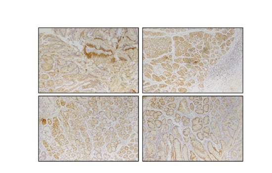 IHC Results of Clone 8
